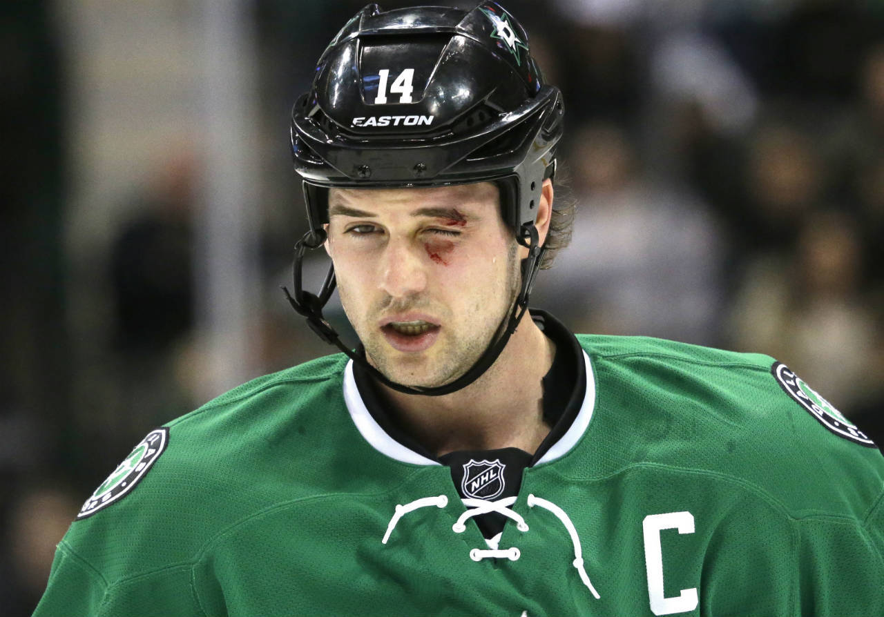 Jamie Benn Bruised Face