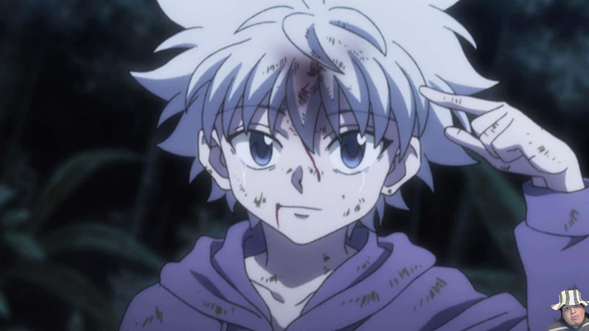 Killua Cute Beaten Background