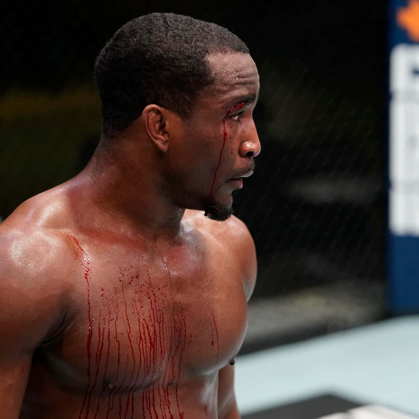 M M A Fighter Bloodiedin Octagon Background