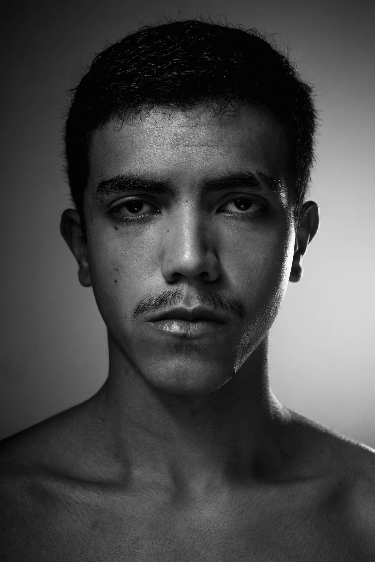 Man With A Scar Black And White Portrait