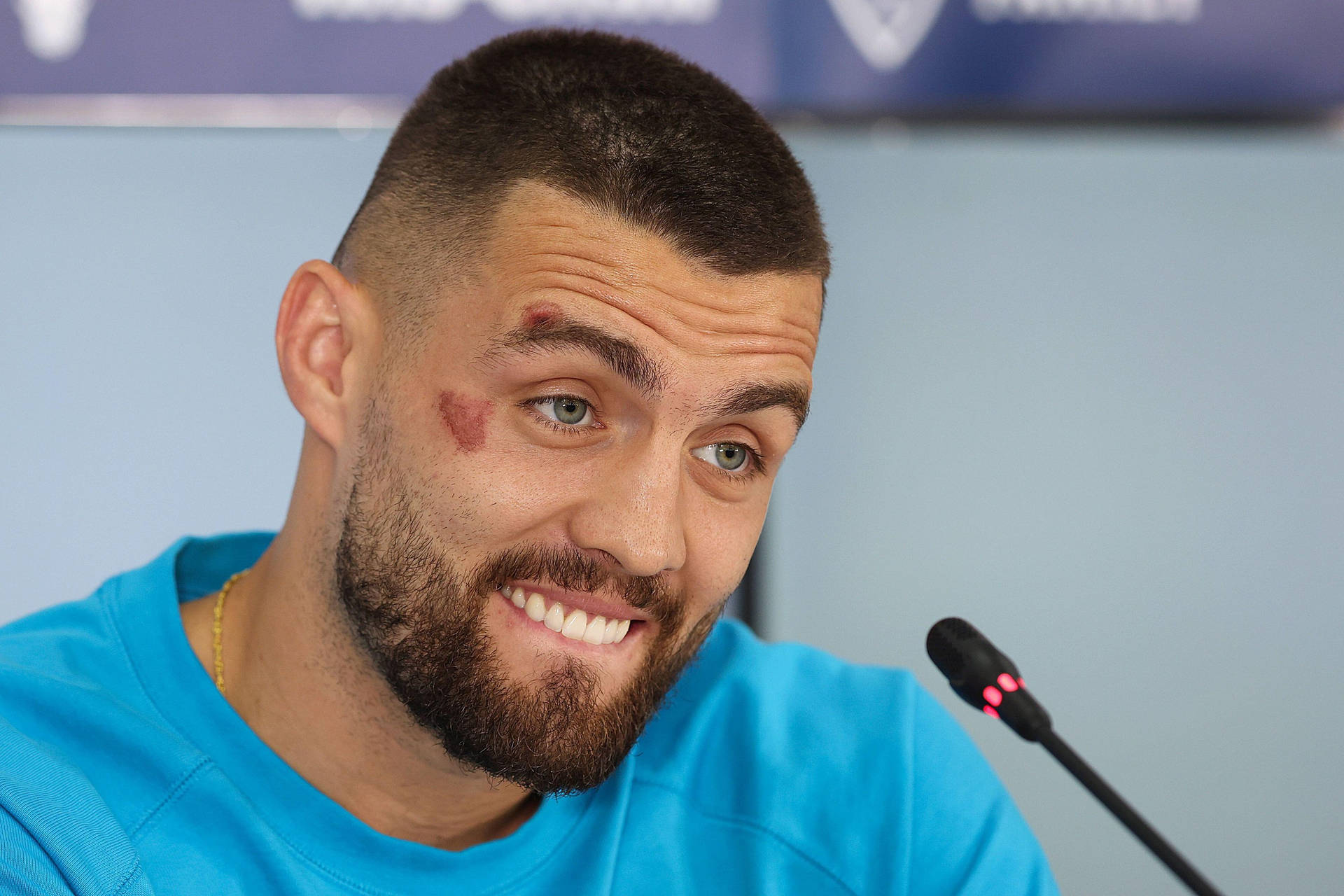 Mateo Kovacic Lip Bite