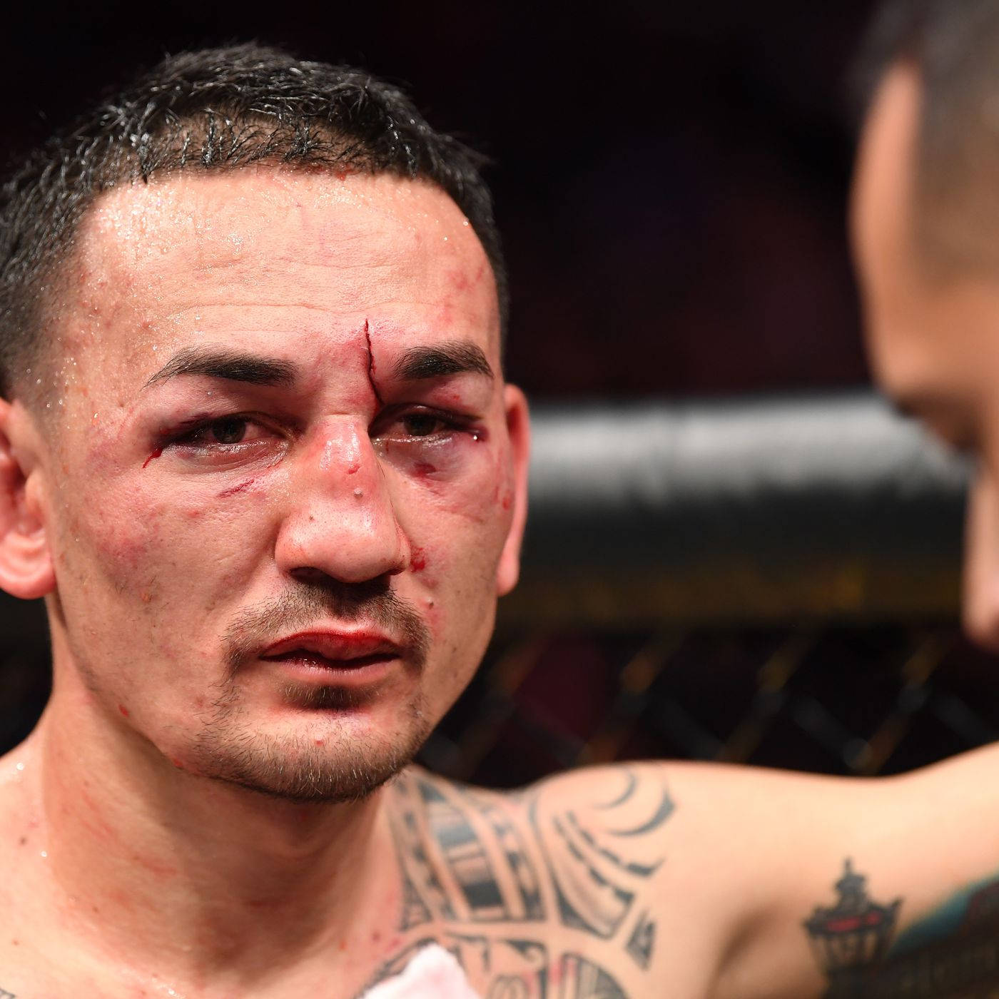 Max Holloway Bloody Cut Face