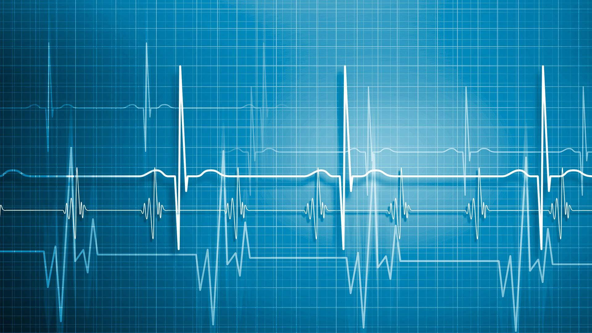 Medical Pulse Rate In Blue Background