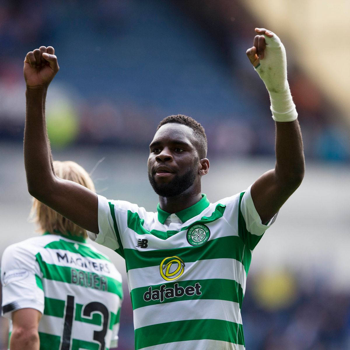 Odsonne Edouard With Bandaged Hand