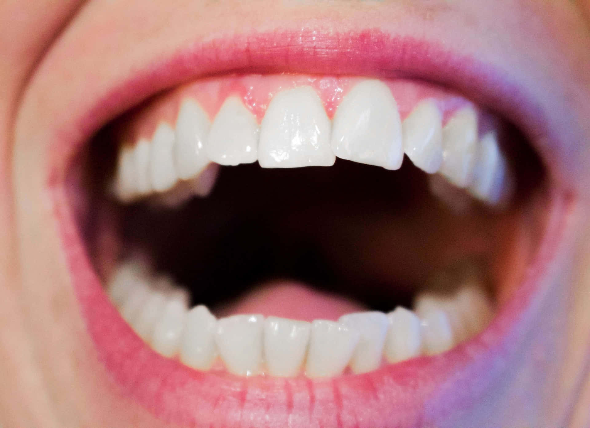 Oral Open Mouth