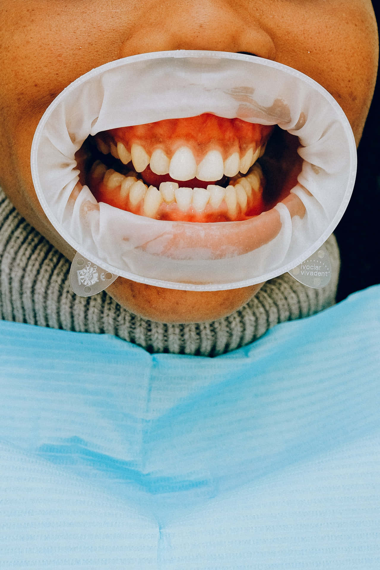 Oral Surgery Image Background
