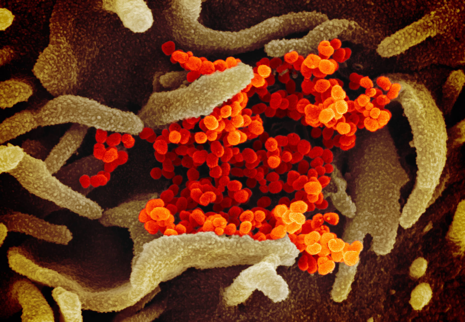 Orange Coronavirus Dna Background