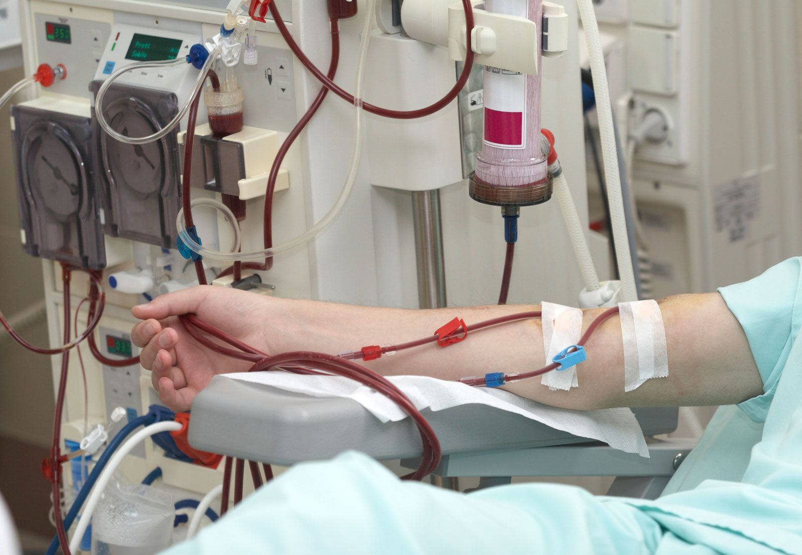 Patient During Dialysis