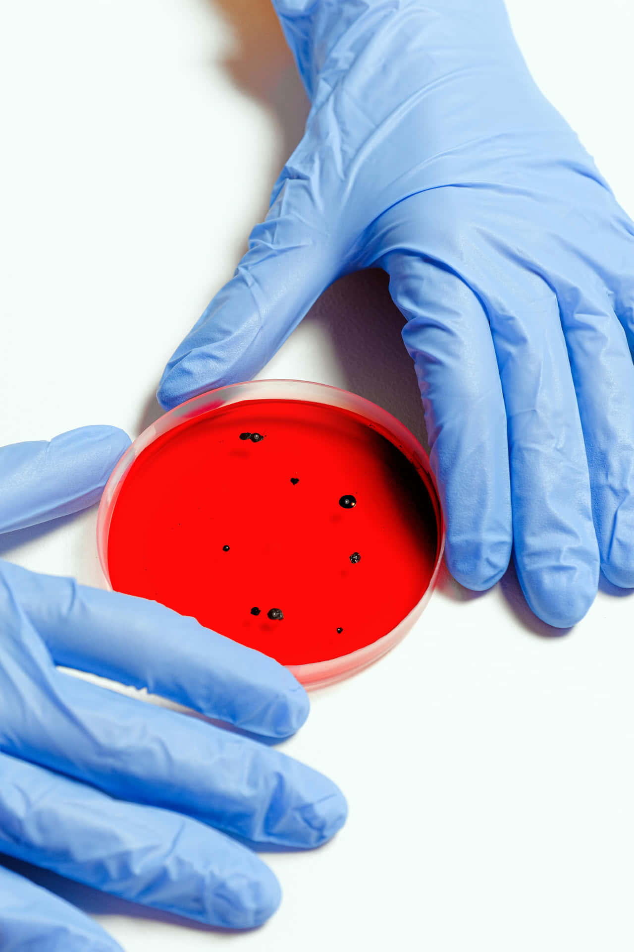 Petri Dish Bacterial Colonies Blue Gloves