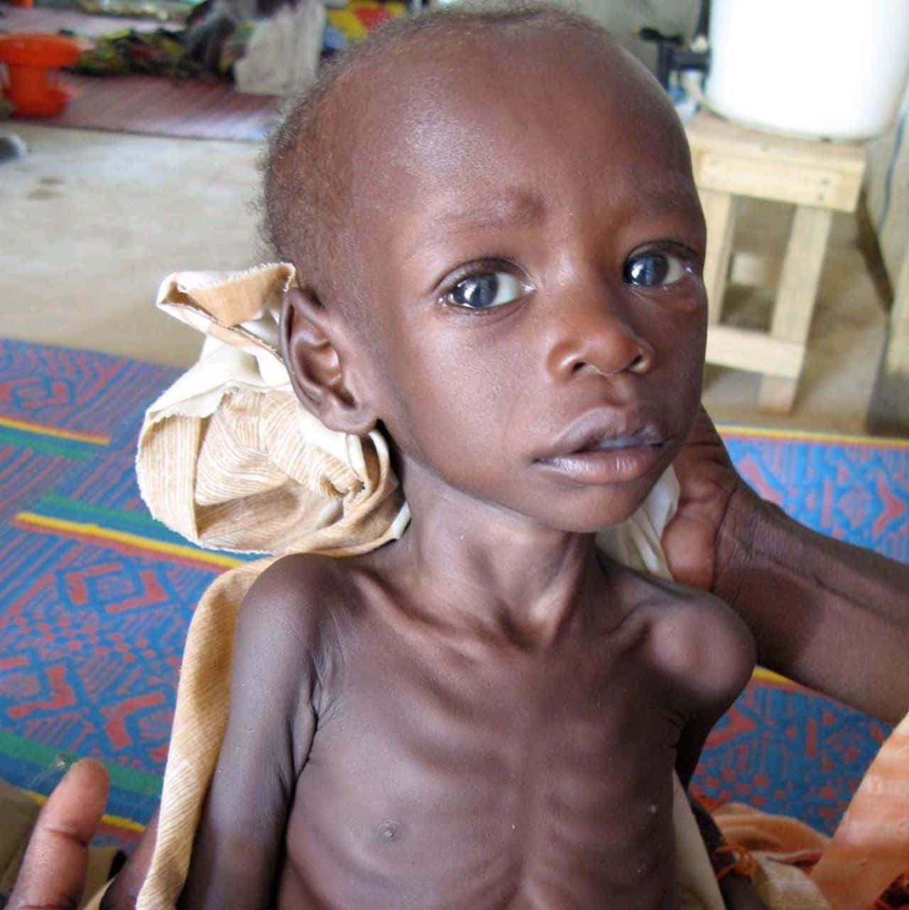 Pitiful Face Of Emaciated Child Background