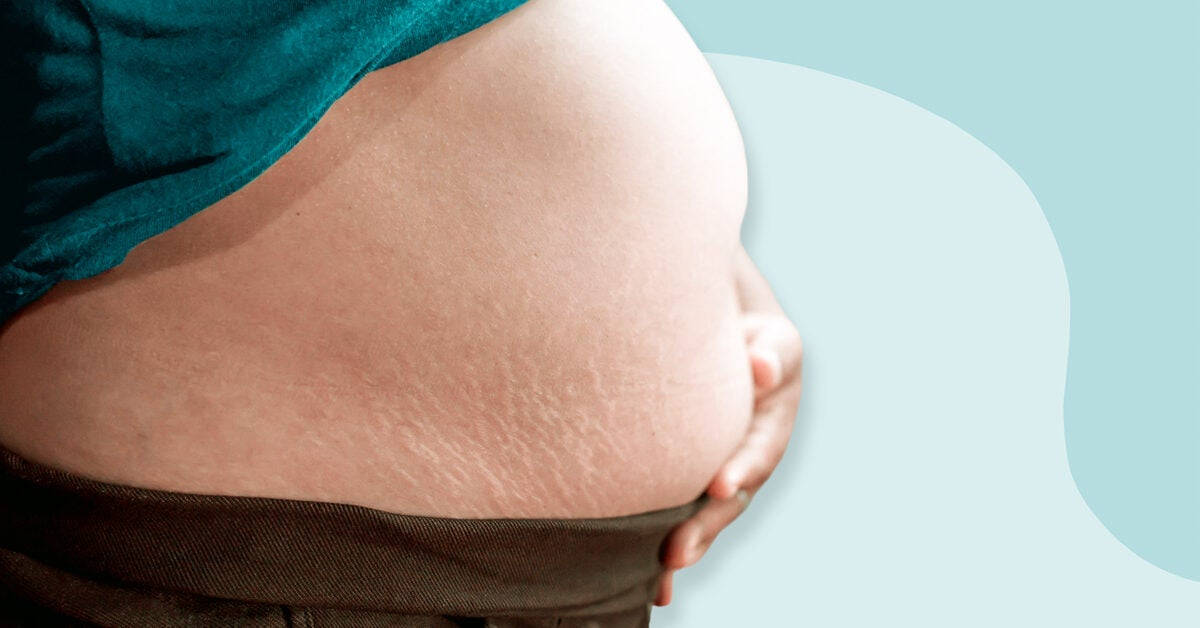 Pregnant Belly Flabby Stomach Background