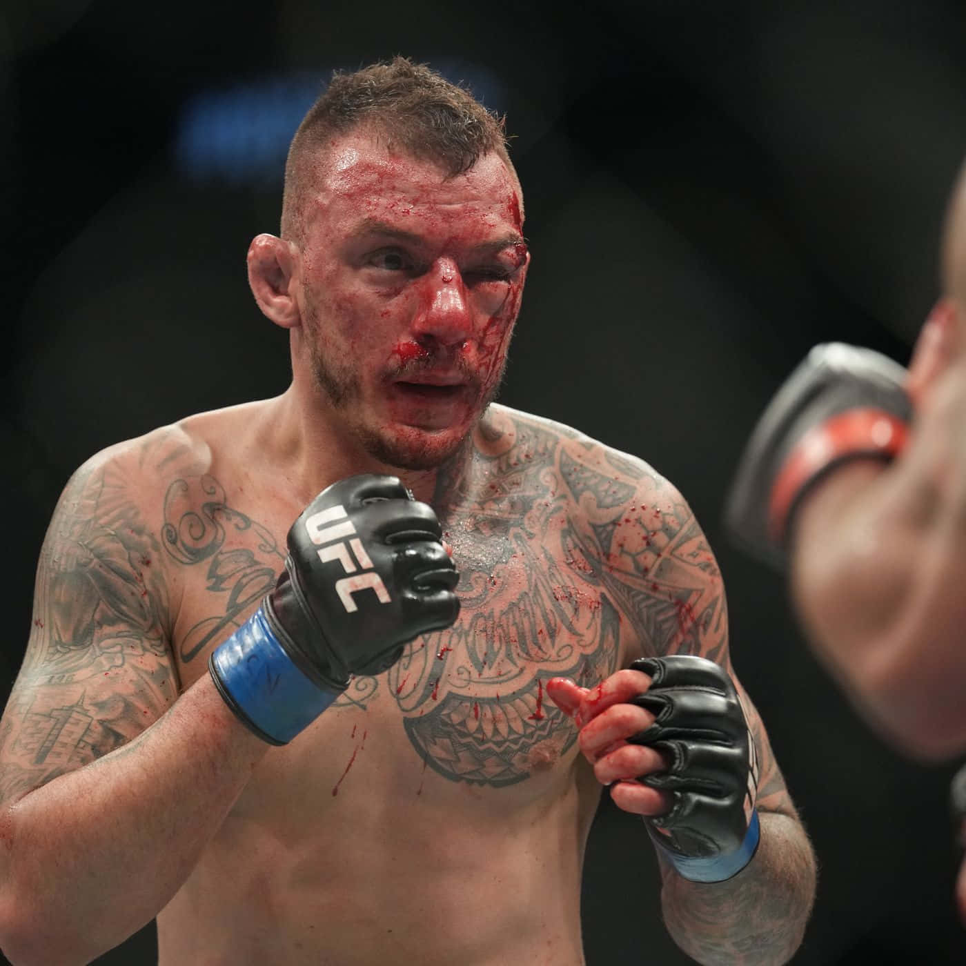 Renato Moicano Injured Eye Background