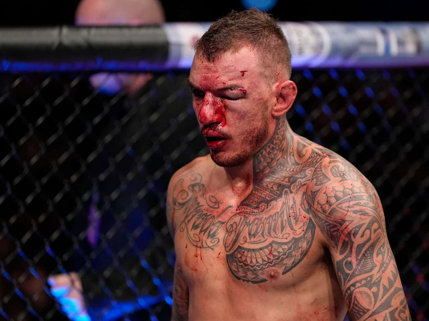 Renato Moicano Injured Face Background