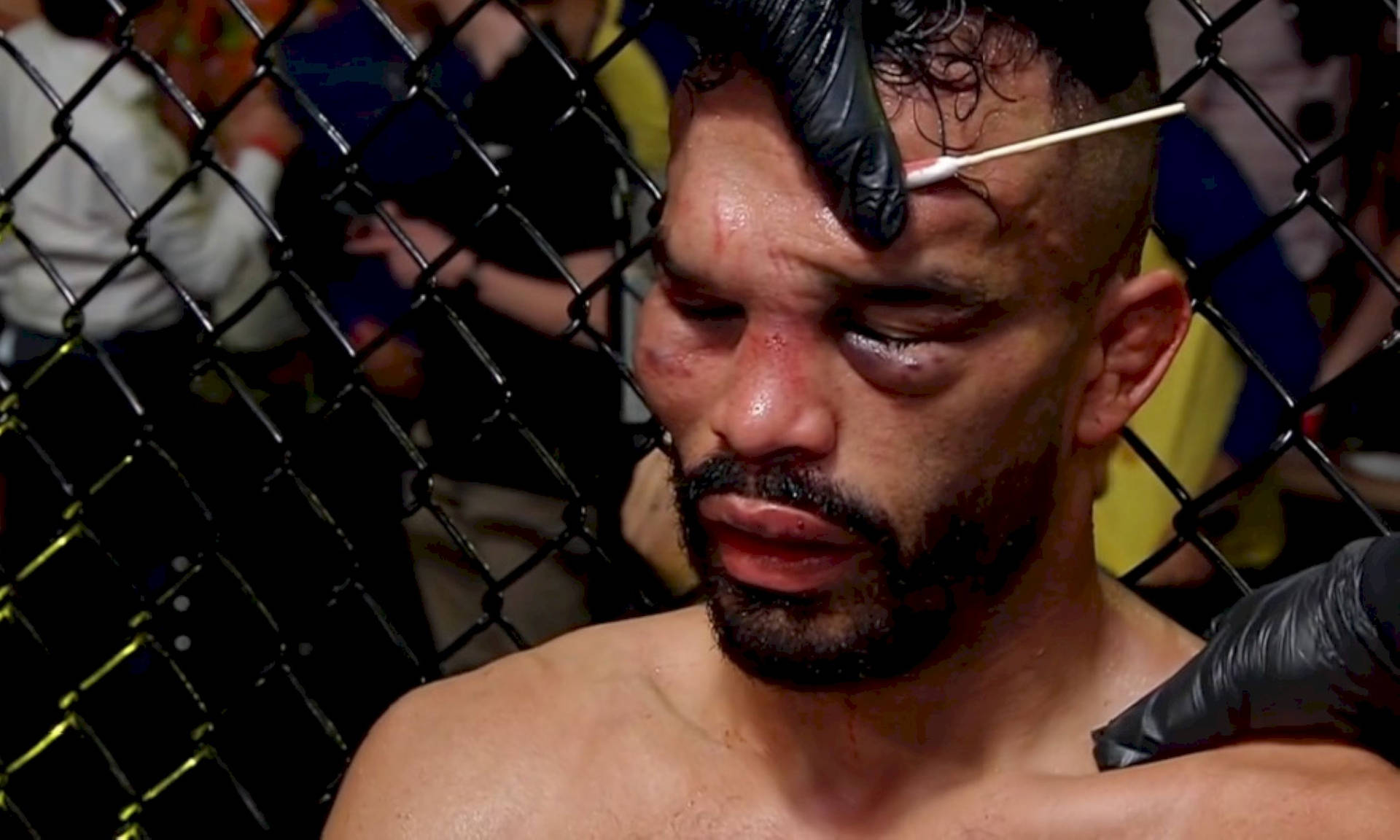 Rob Font Injured After Fight Background