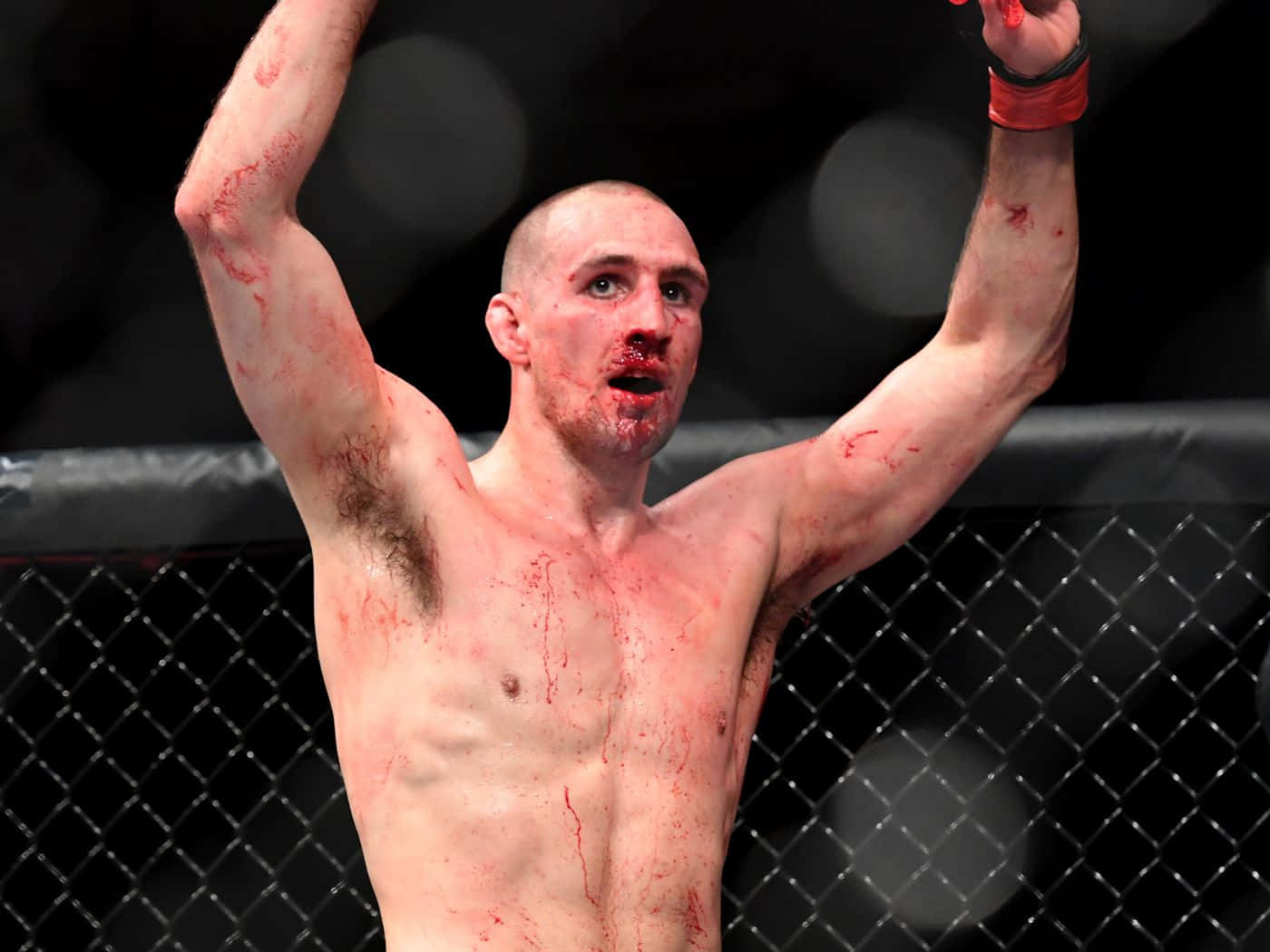 Rory Macdonald Celebrating With Bloody Face Background