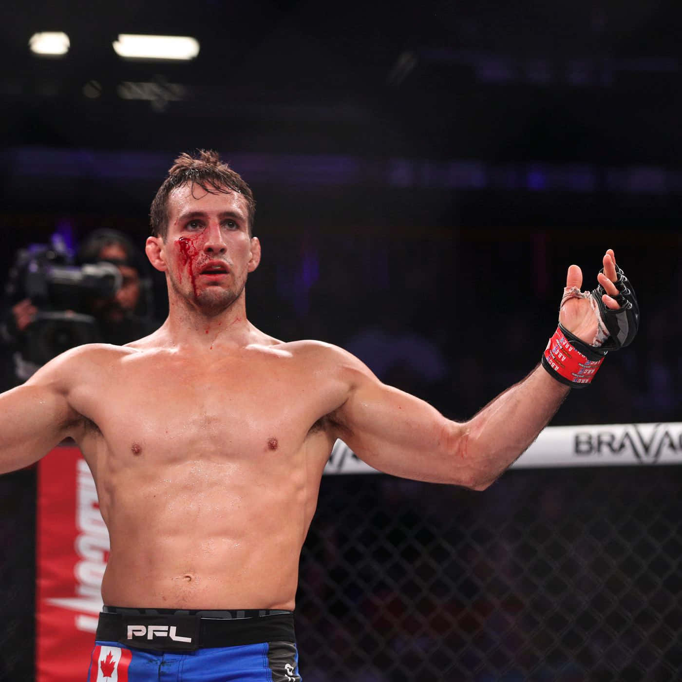 Rory Macdonald Enduring A Fierce Mma Fight