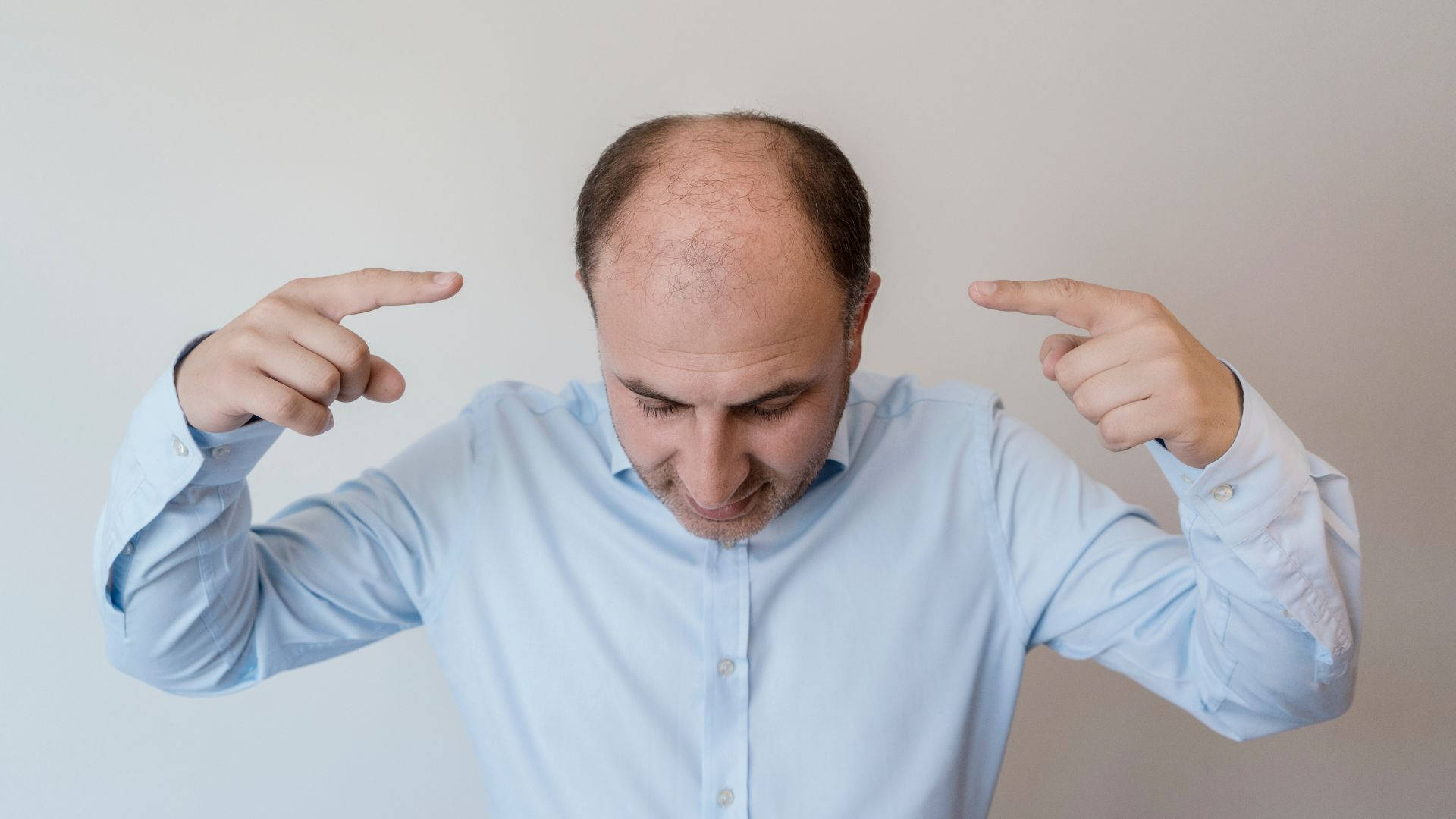 Thoughtful Bald Man Gesturing Towards Head Background