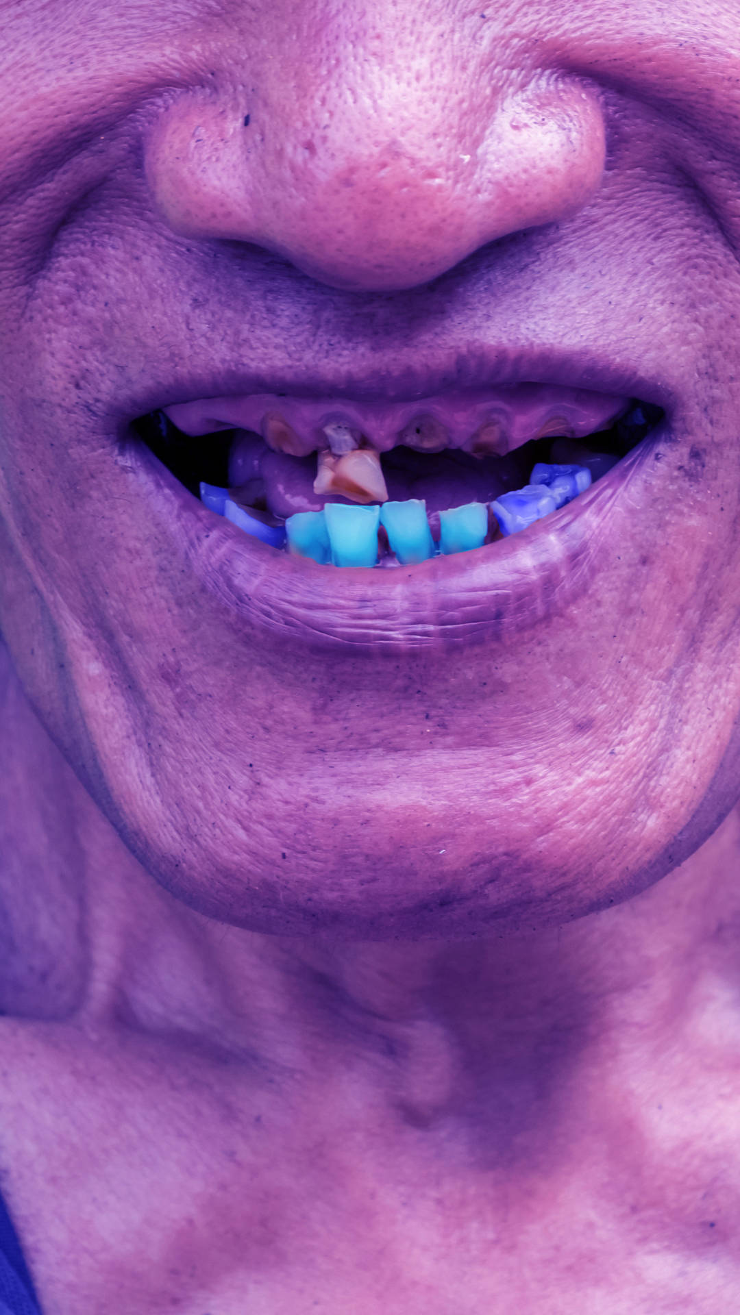 Ugly Blue Teeth