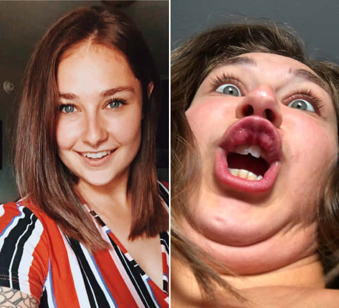 Ugly Funny Comparison Brunette