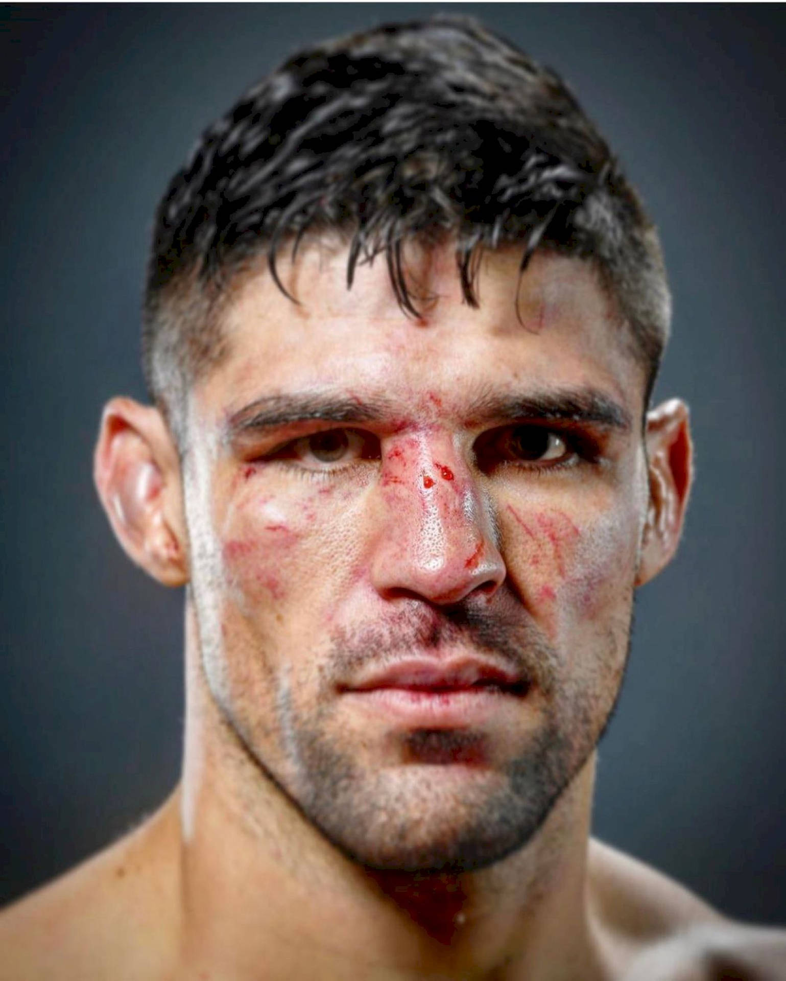 Vicente Luque With Face Injuries Background