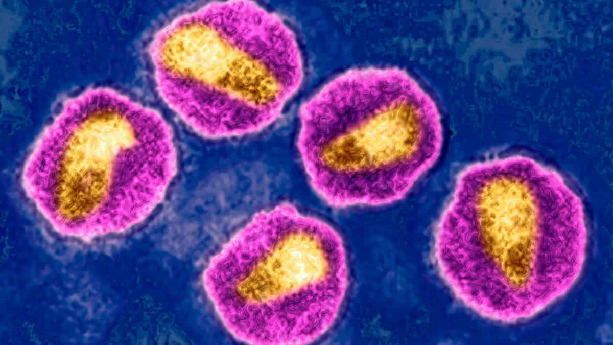 Virulent Strain Of Aids Background