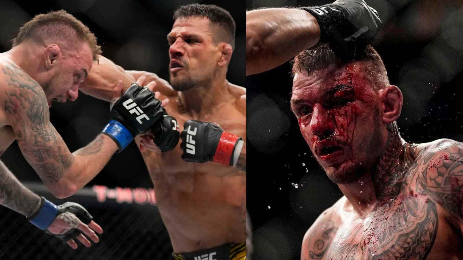 Wounded And Defeated Renato Moicano