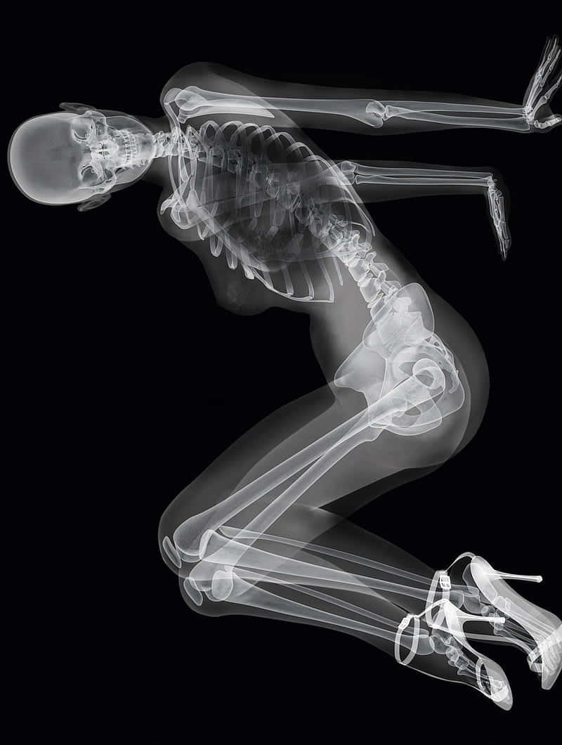 X Ray Of A Skeleton Background