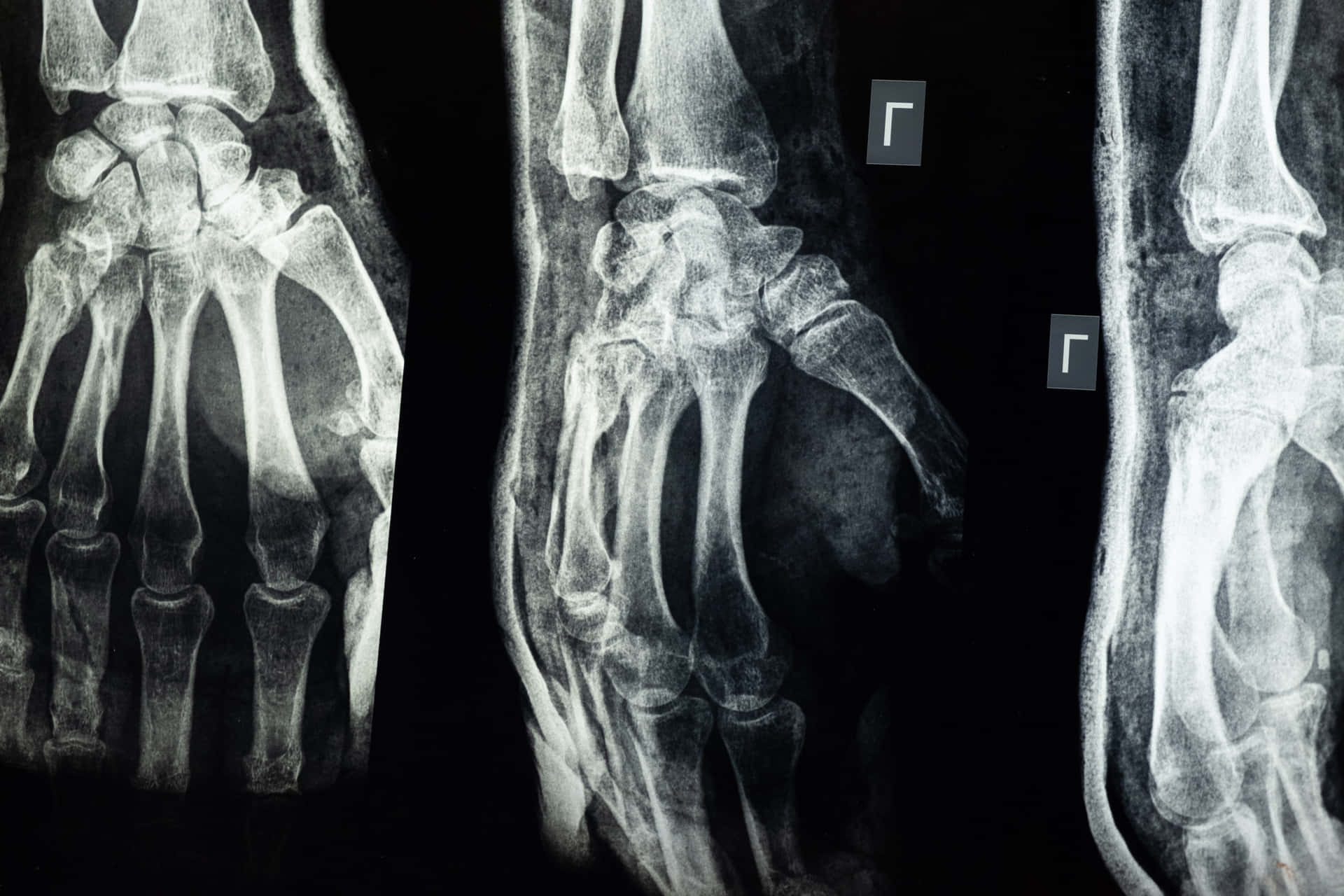 X - Rays Of The Hand And Wrist Background